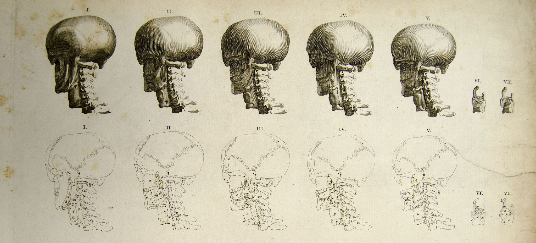 The suture junctions of the human skull can be clearly seen in this anatomical drawing - the wiggling lines on the bottom set of sketches. From Bernhard Siegfried Albinus, Tables of the skeleton and muscles of the human body. Image via the University of Liverpool Faculty of Health & Life Sciences, liverpoolhls on Flickr