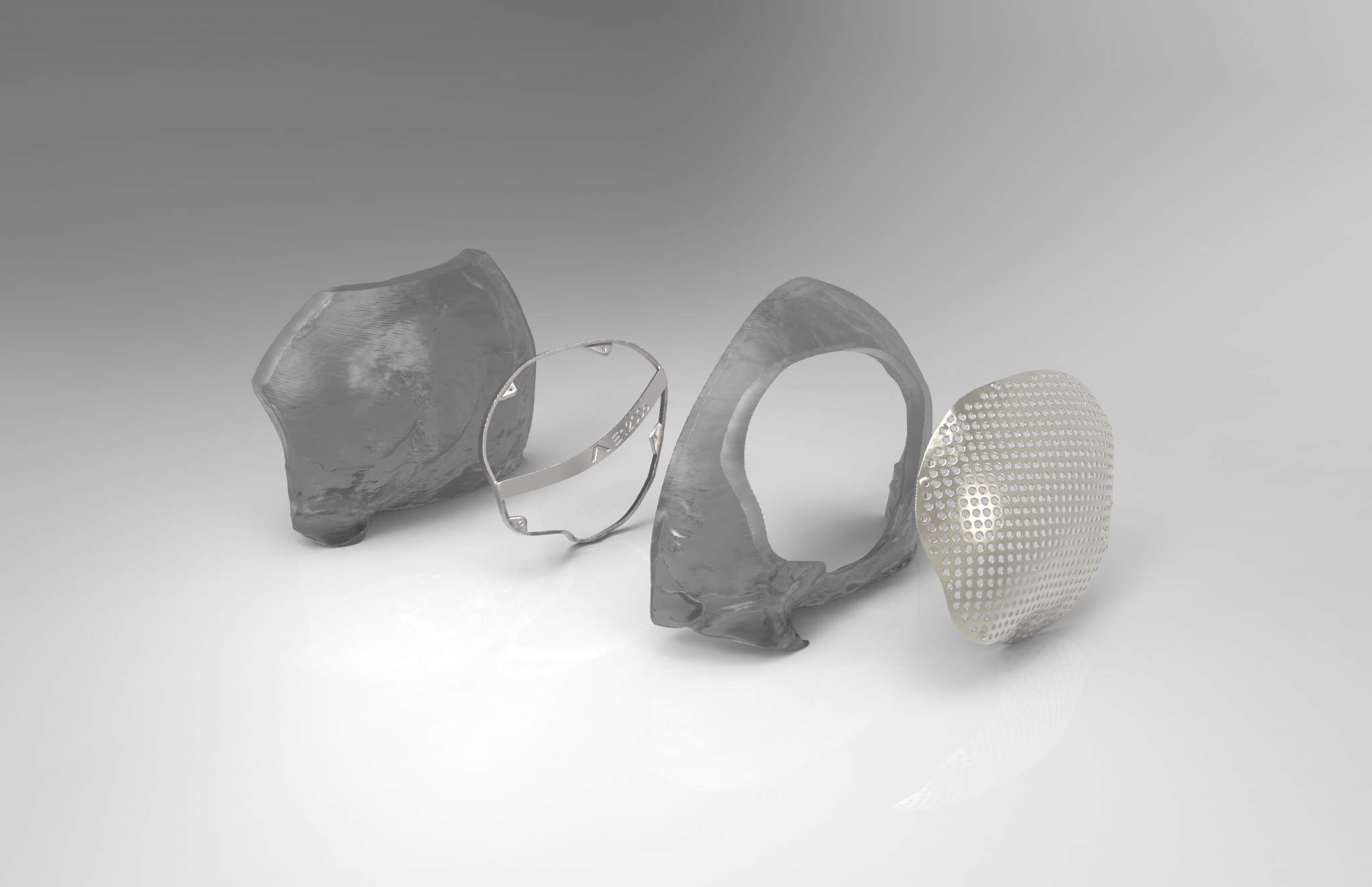 Deconstruction of cranioplasty procedure with 3D printed metal plate. Image via Renishaw.