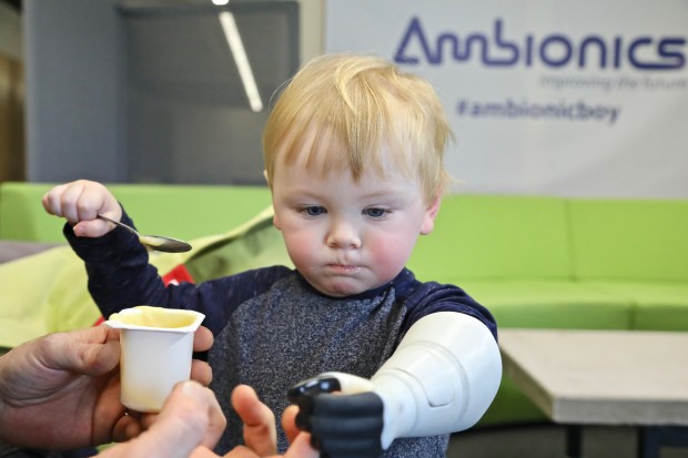 Sol holds on to his father's hand with the prosthetic arm as he eats. Photo via Ben Ryan on Indiegogo
