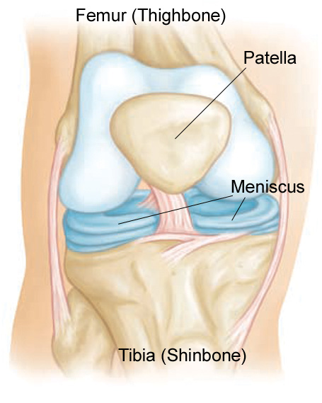 The Meniscus is the shock absorbing cartilage between the thigh bone (femur) and the shin bone (tibia). 