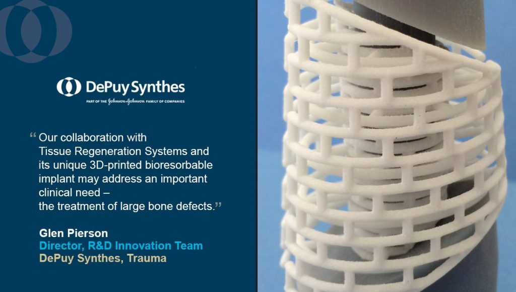 A demonstration of 3D printed implants. Quote inset from Glen Pierson, Director R&D Innovation Team, DePuy Synthes. Image via @DePuySynthes on Twitter