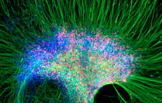 Neural Stem Cells. Image via the Regeneration Center of Thailand.
