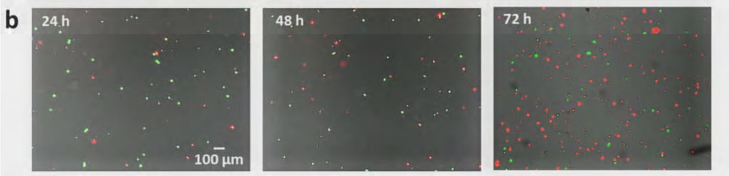 Imaging of live/dead cancer cells after sperm used as drug delivery systems. Green dots show living cells, red dots show dead cells. Figure via Xu, Sanchez, Magdanz, Schwarz, Hebenstreit & Schmidt