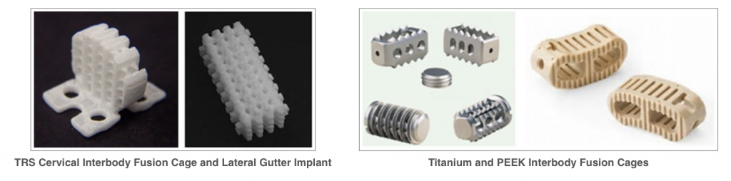 Example of 3D printed cages from Tissue Regeneration Systems (left) and titanium and PEEK lumbar cages for use in the spine (right). Image via tissuesys