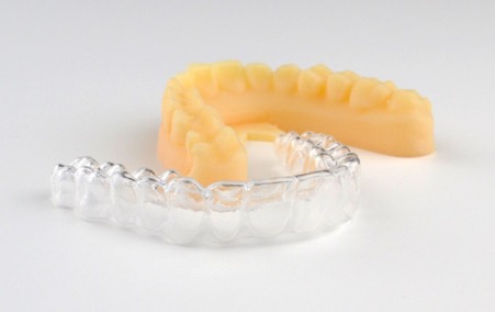 3D printed dental cast and clear aligner model. Photo via Stratasys