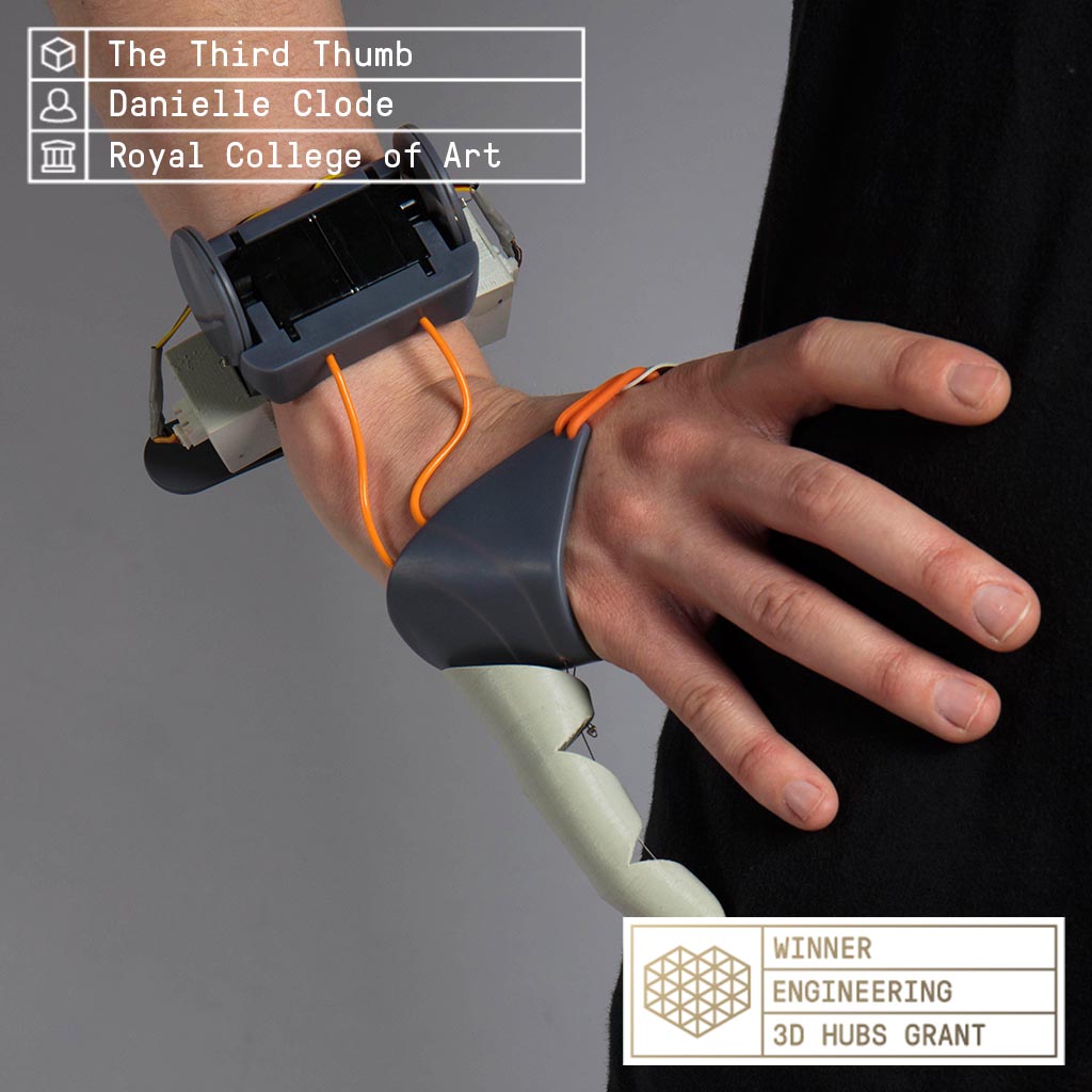 Dani Clode's Third Thumb prosthesis winner of the engineering category. Image via 3D Hubs. 