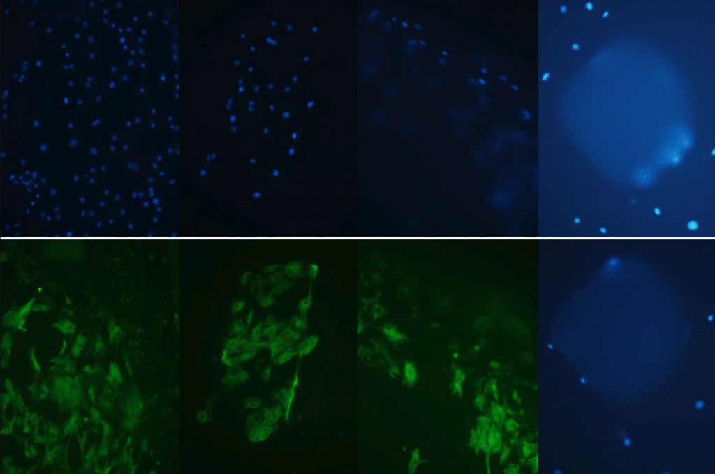 Coated in fluorescent dyes, cells added to the device glow. Green dye shows cells living in various compartments of the device, and blue shows their communication through the central grid. Image via The International Journal of Advanced Manufacturing Technology