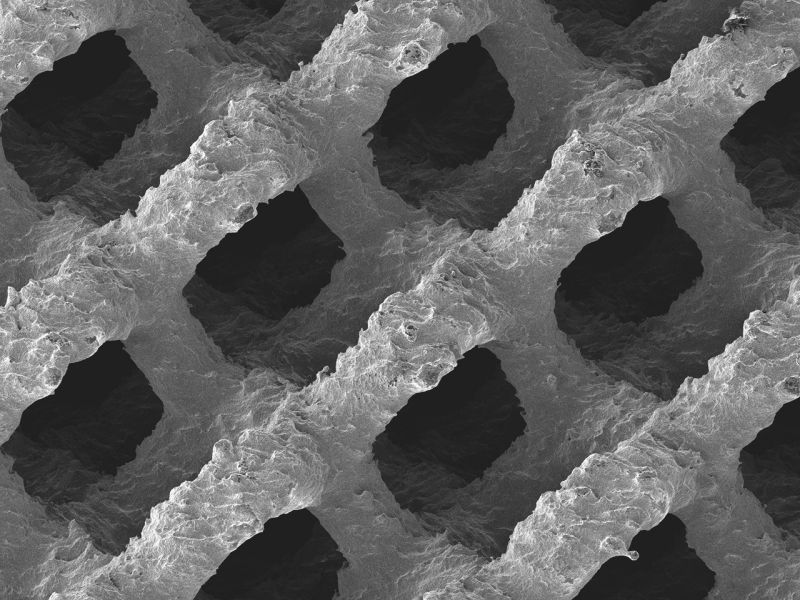 Surface structure of an FDA approved 3D printed cellular titanium implant. Image via EIT