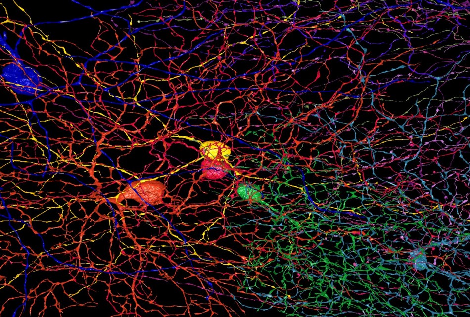 Map of retinal neurones in the human brain. Image via EyeWire.
