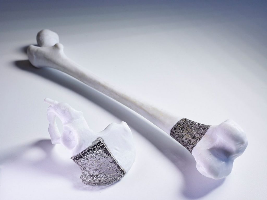 Example of products from the Just in time implants project funded by Stryker and the IMRC. Photo via IMRC