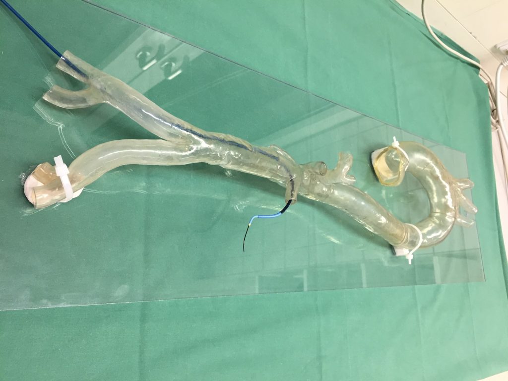 The 3D printed model of the aortic arch aneurysm used to practice surgery at University Hospital Mainz. Photo via Stratasys