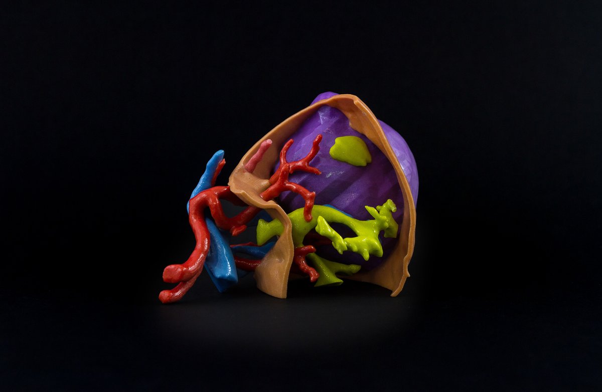 A 3D printed anatomical heart model. Photo via Materialise NV