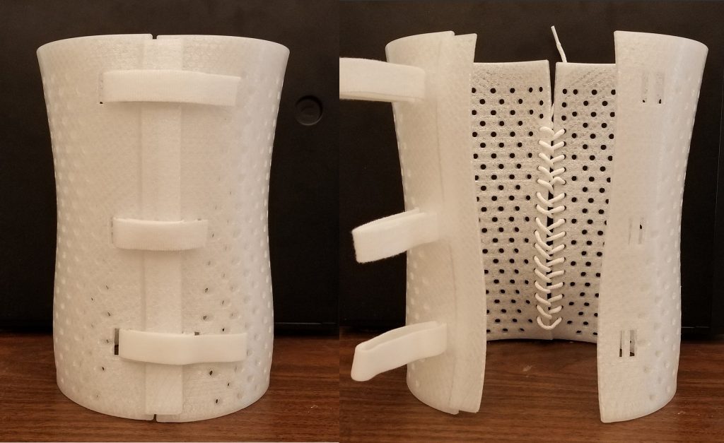 A prototype back brace designed and 3D printed at UVic. Photo by Derek Bell via Grand Challenges Canada