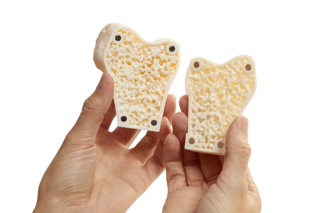 3D printed model of cancellous bone tissue using GrabCAD. Photo via Stratasys.