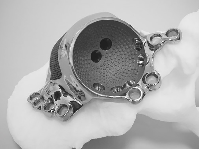 The finished 3D printed titanium implant. Photo via Materialise