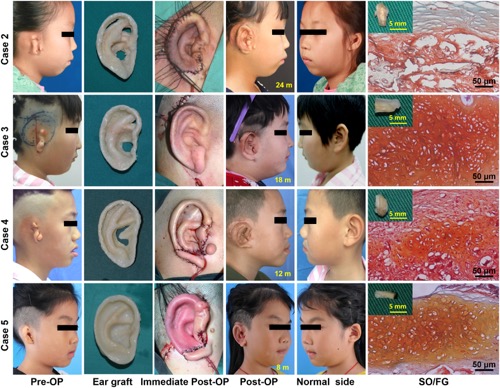 The subjects of the study. Image via EBiomedicine.