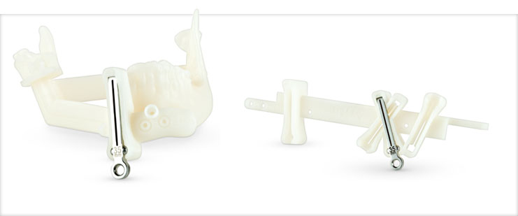 3D printed models from VSP Reconstruction. Image via Stryker.