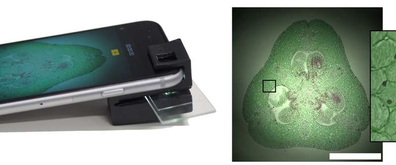 The clip-on device and resulting microscope image (right). Image via RMIT/CNBP