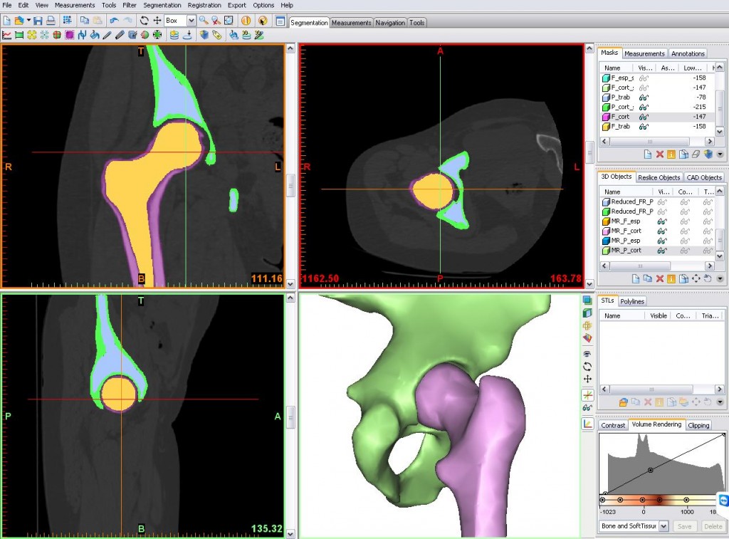 CT images viewed in Materialise's Mimics software. Image via Materialise.