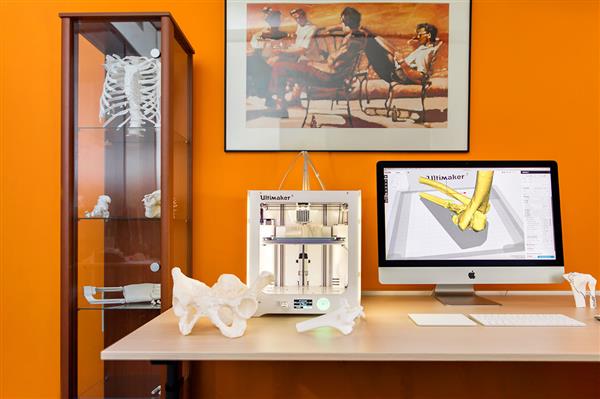 Elisabeth-TweeSteden Ziekenhuis trauma center uses the Ultimaker 3 3D Printer to print 3D models of patients' bones. Photo via Elisabeth-TweeSteden Ziekenhuis..
