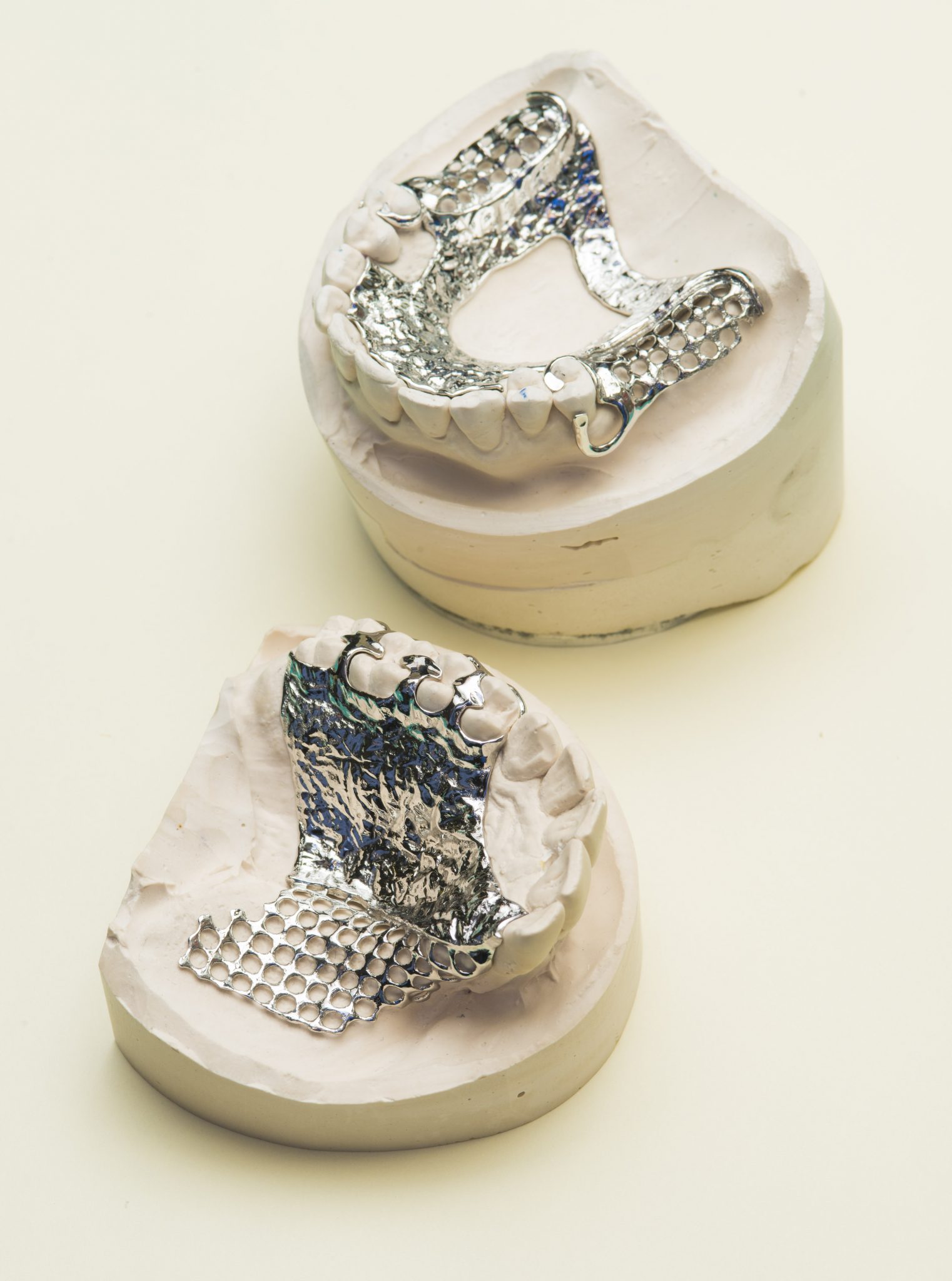 CoCr 3D printed removable partial dentures. Photo via Renishaw.