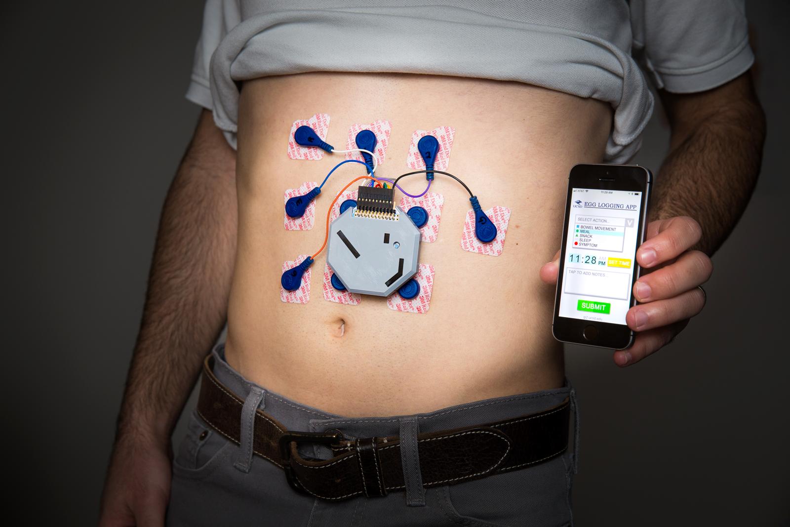 Researchers have 3D printed a wearable system to monitor stomach activity, that can be used outside of a clinical environment. Photo via UCSD.