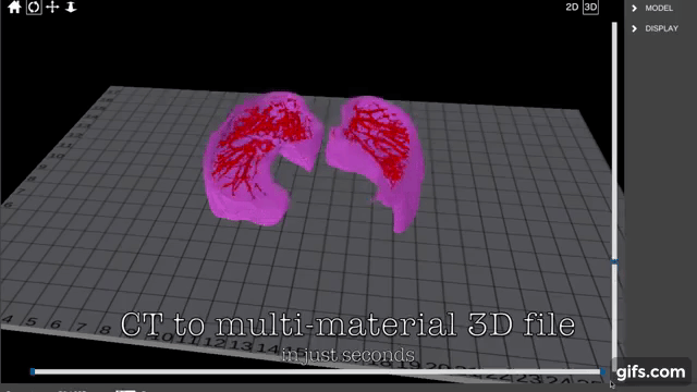Simulation of an AI generated lung model, from CT scan to 3D printable model. Clip via Aether 3D Bioprinter on YouTube