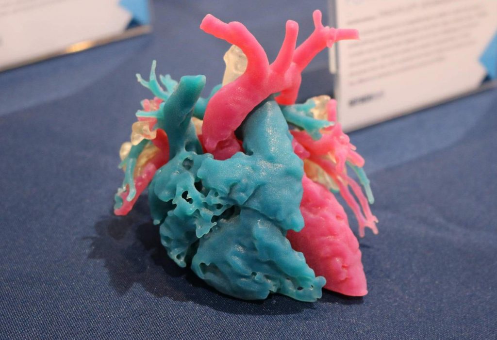 A 3D printed heart model. Photo via Stratasys