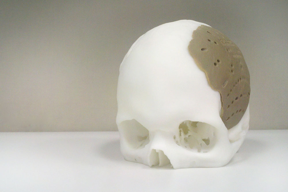 A 3D printed skull with an OXPEKK cranial implant. Photo via Oxford Performance Materials