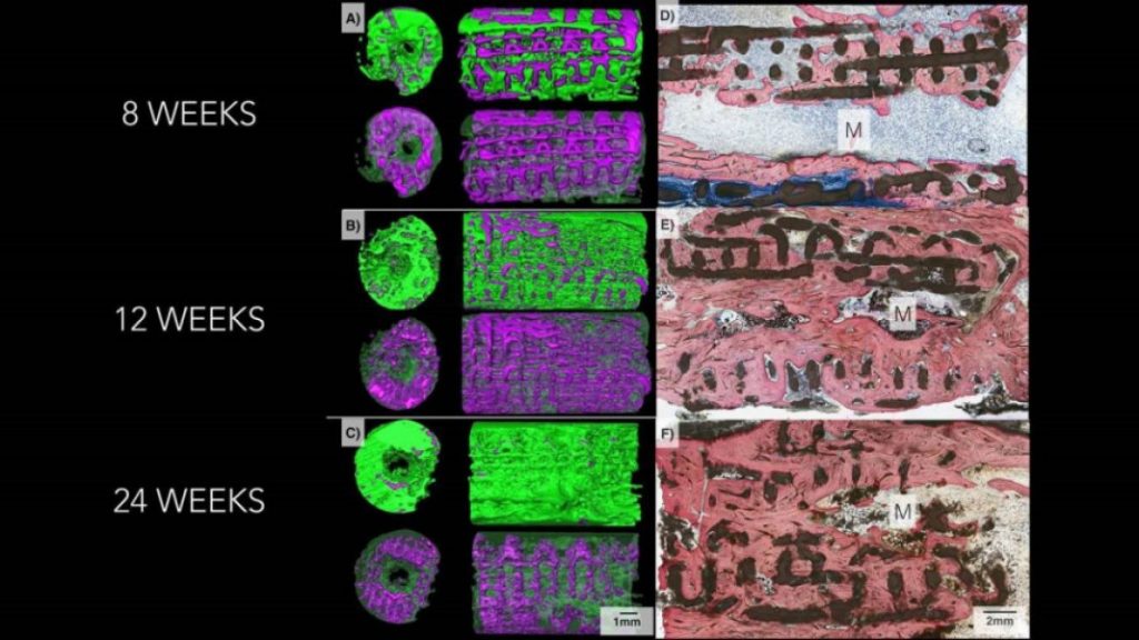 3D imaging showing bone growing through a 3D printed implant over the course of 6 months. In images A. B, C, bone is colored green and implant is colored purple. In D, E, F bone is stained pink, and the scaffold is shown in black. Image via Journal of Tissue Engineering and Regenerative Medicine