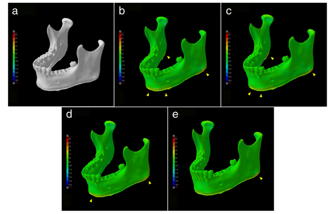 A visualization of shape error, d-e shows that the deformation of shape was due to the model's own weight. Photo via Springer International Publishing