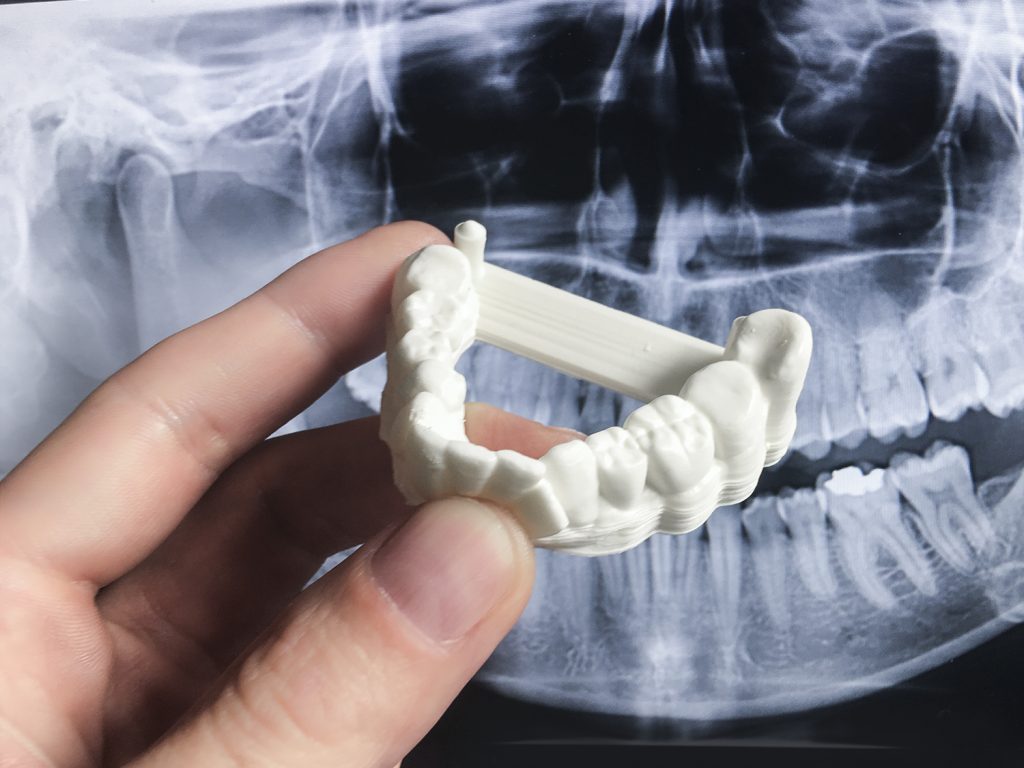 An Inkspire 3D printed dental model. Photo via Zortrax