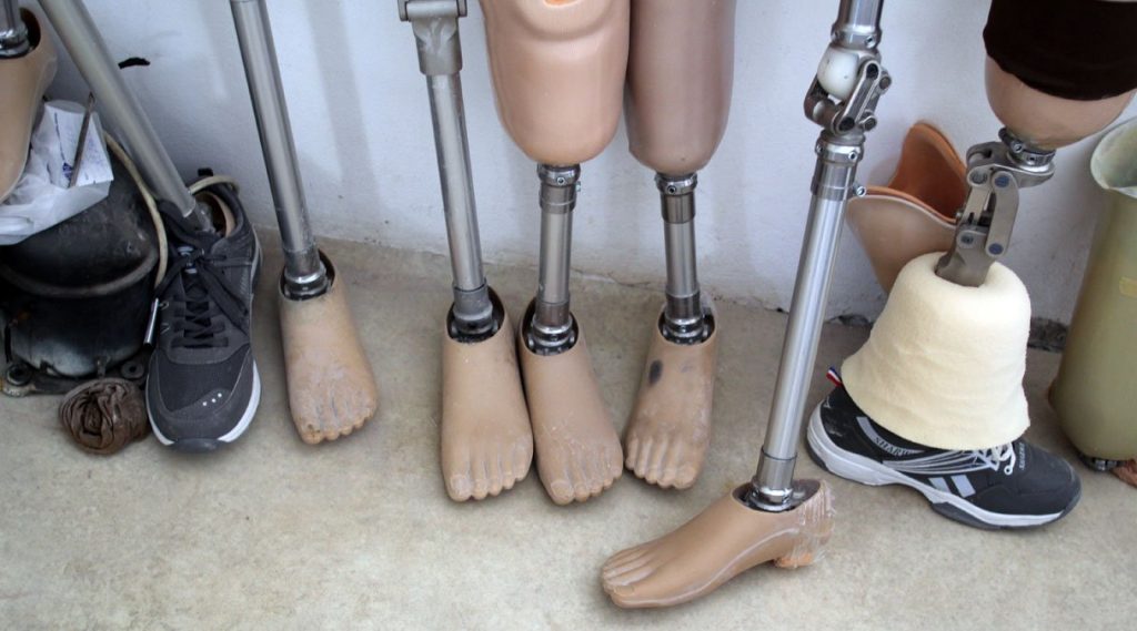 Featured image shows a collection of prosthetics currently used by Syria Relief. Photo via Syria Relief