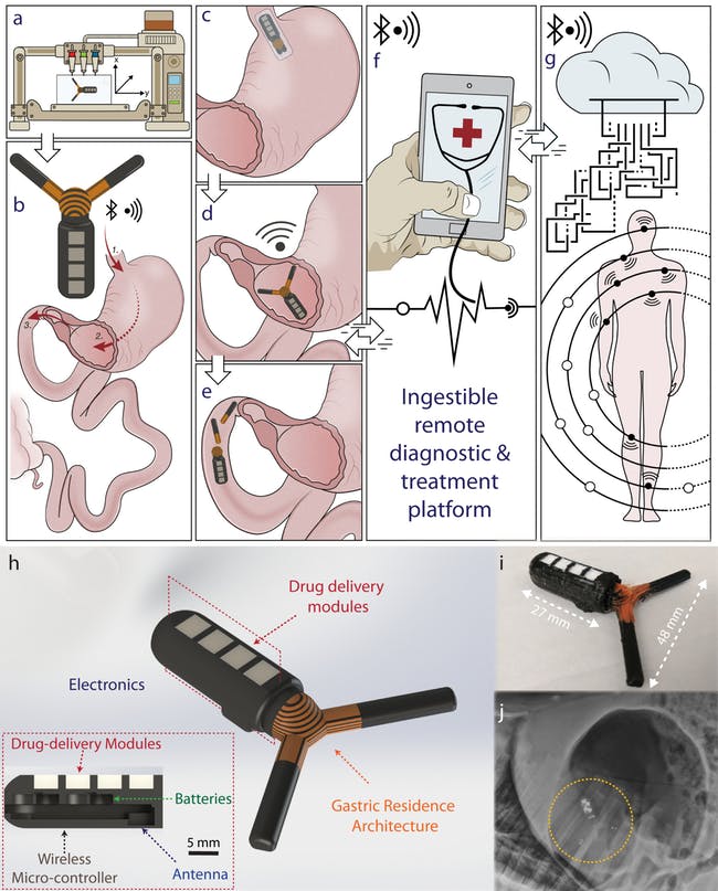 Design of MIT's 3D printed GRE ingestible device and its journey through the body. Image via Advanced Materials Technologies 