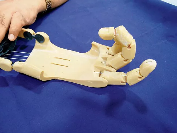 A 3D printed hand prosthetic created by Anatomiz3D. Photo via Anatomiz3D.