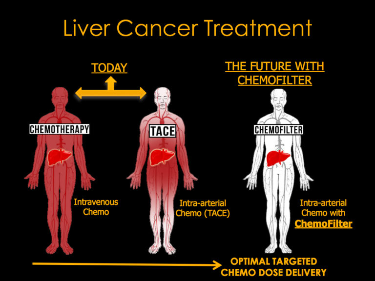 Graphical demonstration of how chemotheraphy drugs spread through the body. Image via UC Berkeley