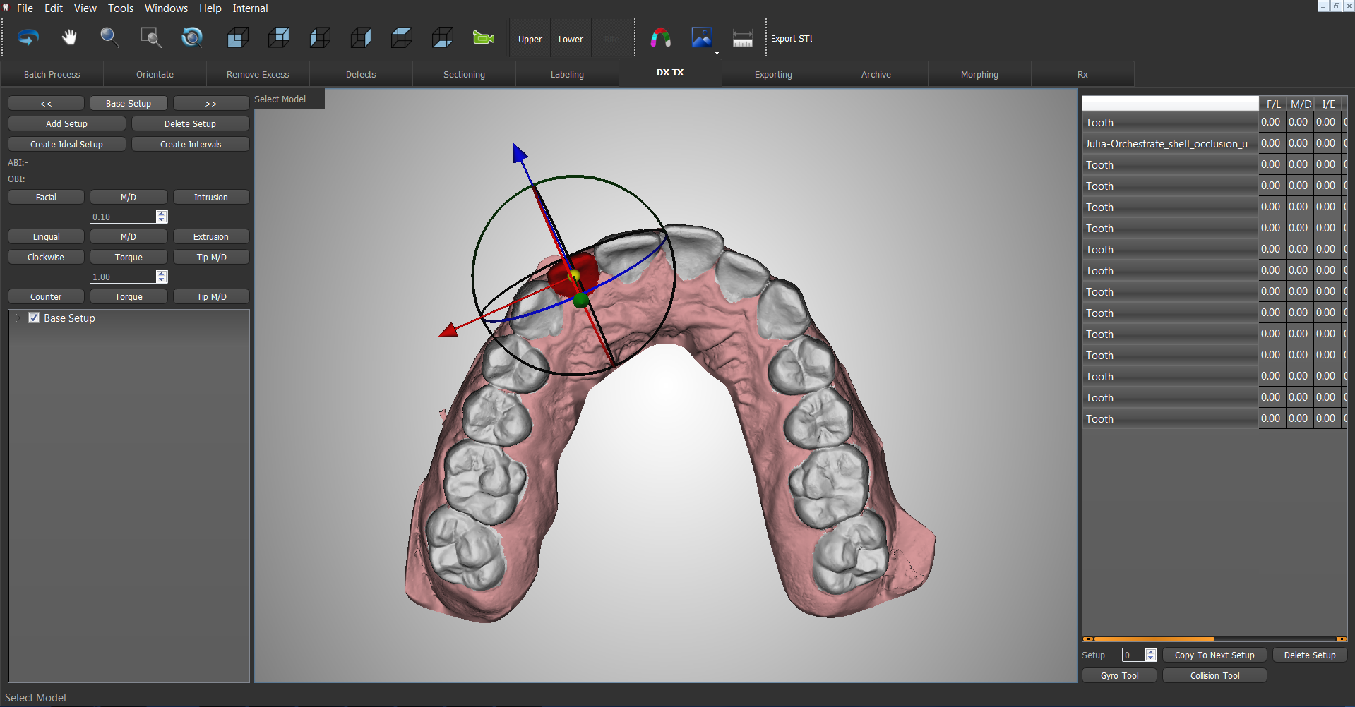Advanced diagnosis of a 3D dental scan orthodontic appliance design. Image via O3D.
