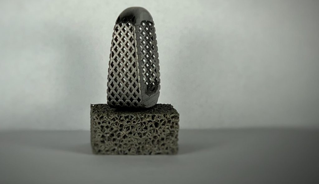 A Tangible Solutions 3D printed titanium implant. Photo via Tangible Solutions