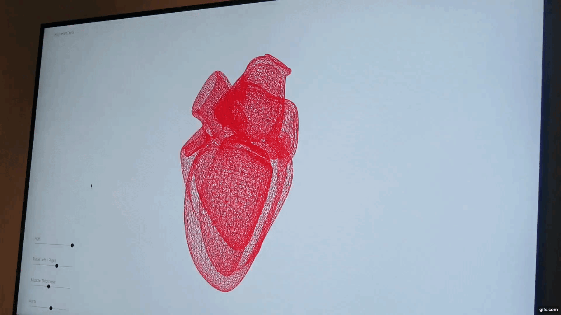 The Big Heart Data system. Clip via Tia Vialva.