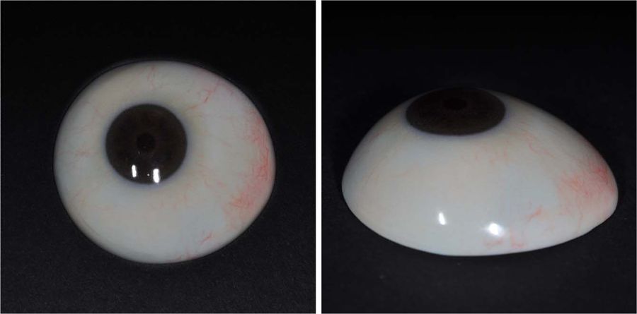 Final output of the customized ocular prosthesis fabricated using 3D printing and surface printing. Image via Severance Hospital.
