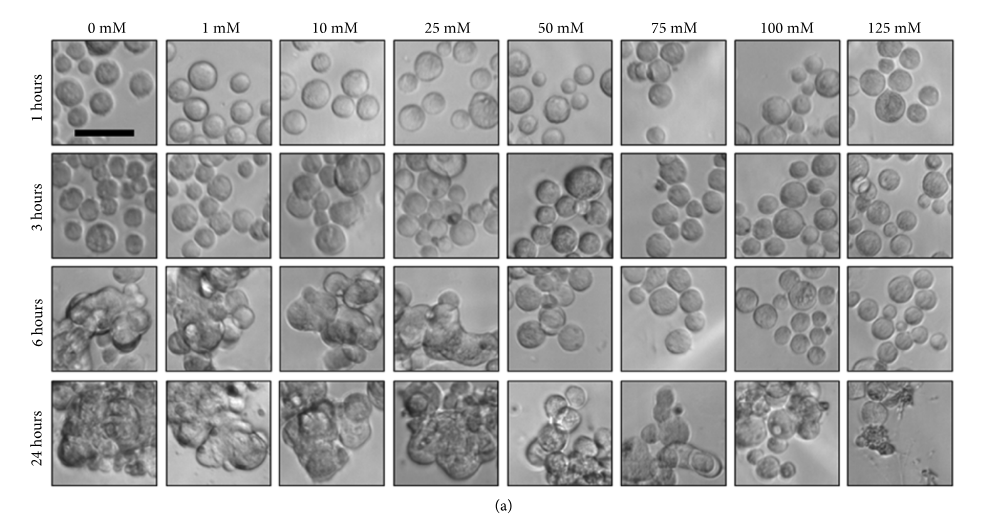 Effect of Gd-DTPA on cell morphology. The breast cancer cells morphologies accumulate malignant plasma cells (mM) in a range from 0, 1, 10, 25, 50, 75, 100, and 125 within 24 hours. Image via McMasters University.