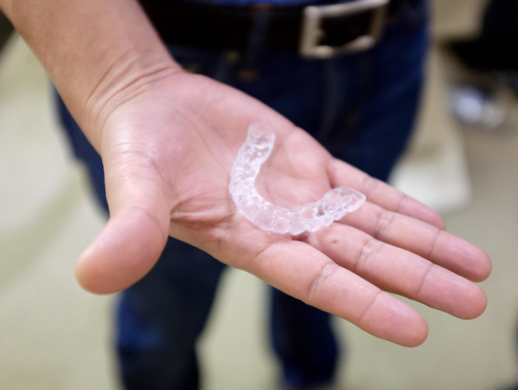 Aligners produced using uLab 3D dental software. Photo via uLab Systems.