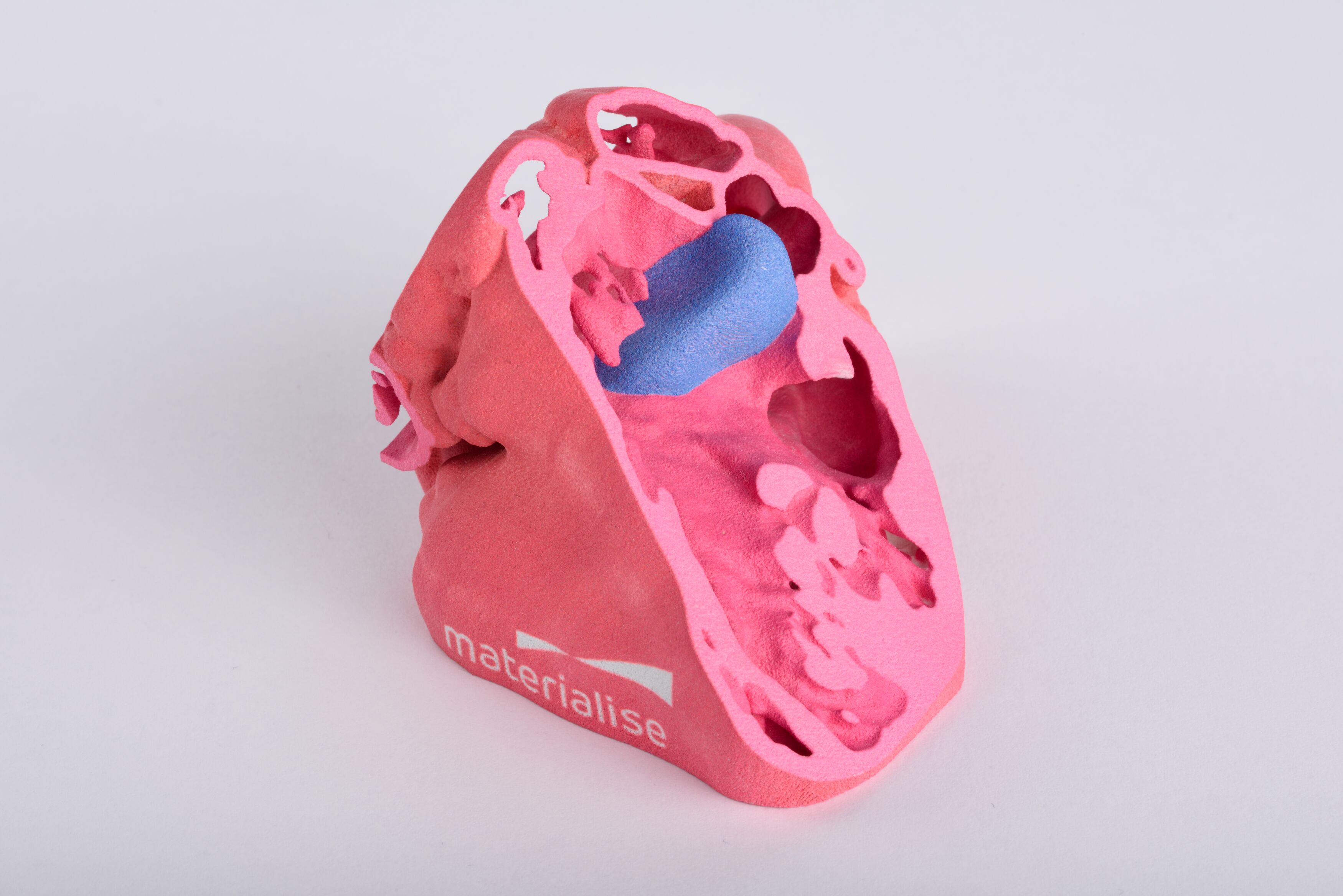 An anatomical 3D printed heart model made by Materialise and HP. Photo via Materialise.