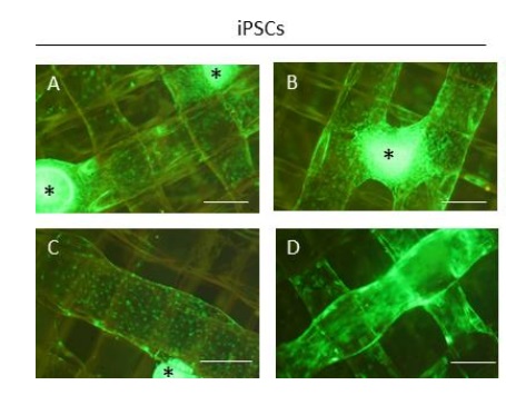 (A-D) IPSCs seeded as colonies and differentiated for 21 days on the 3D scaffold. The four images of the iPSCs are provided to demonstrate the heterogeneity in their distribution. Image via AHT/UEA.