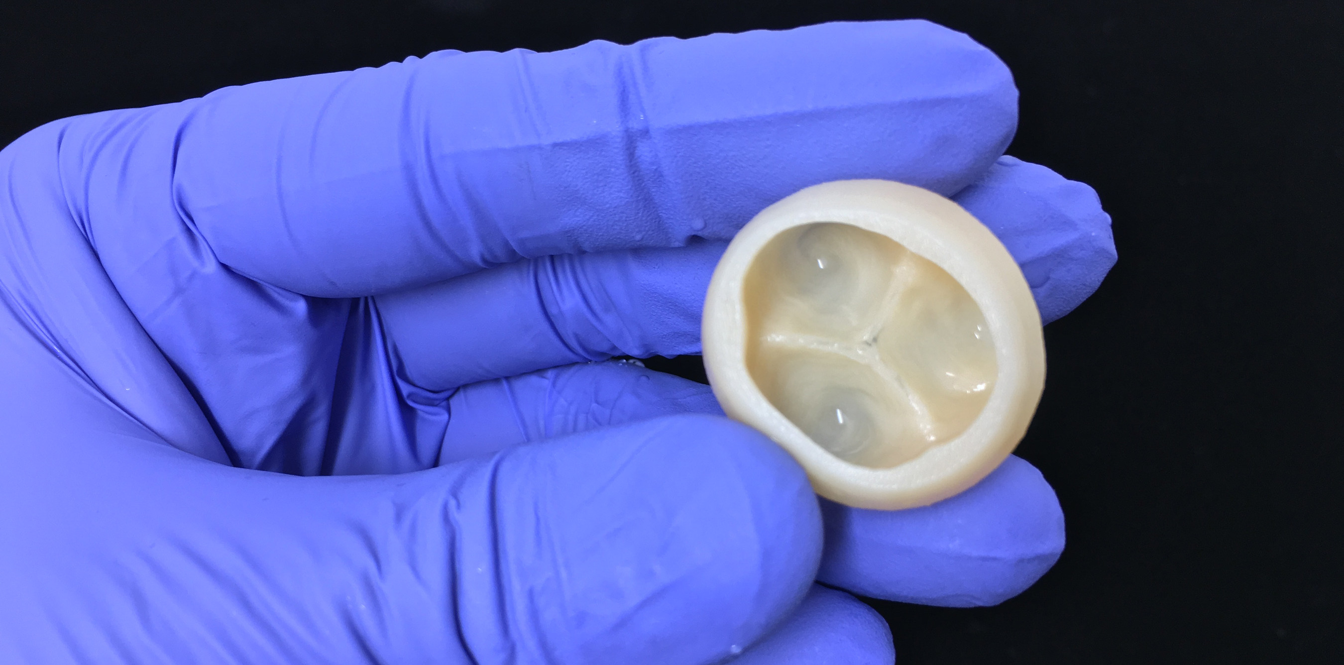 Trileaflet heart valve printed using collagen and Freeform Reversible Embedding of Suspended Hydrogels (FRESH) technology. Photo via CMU.