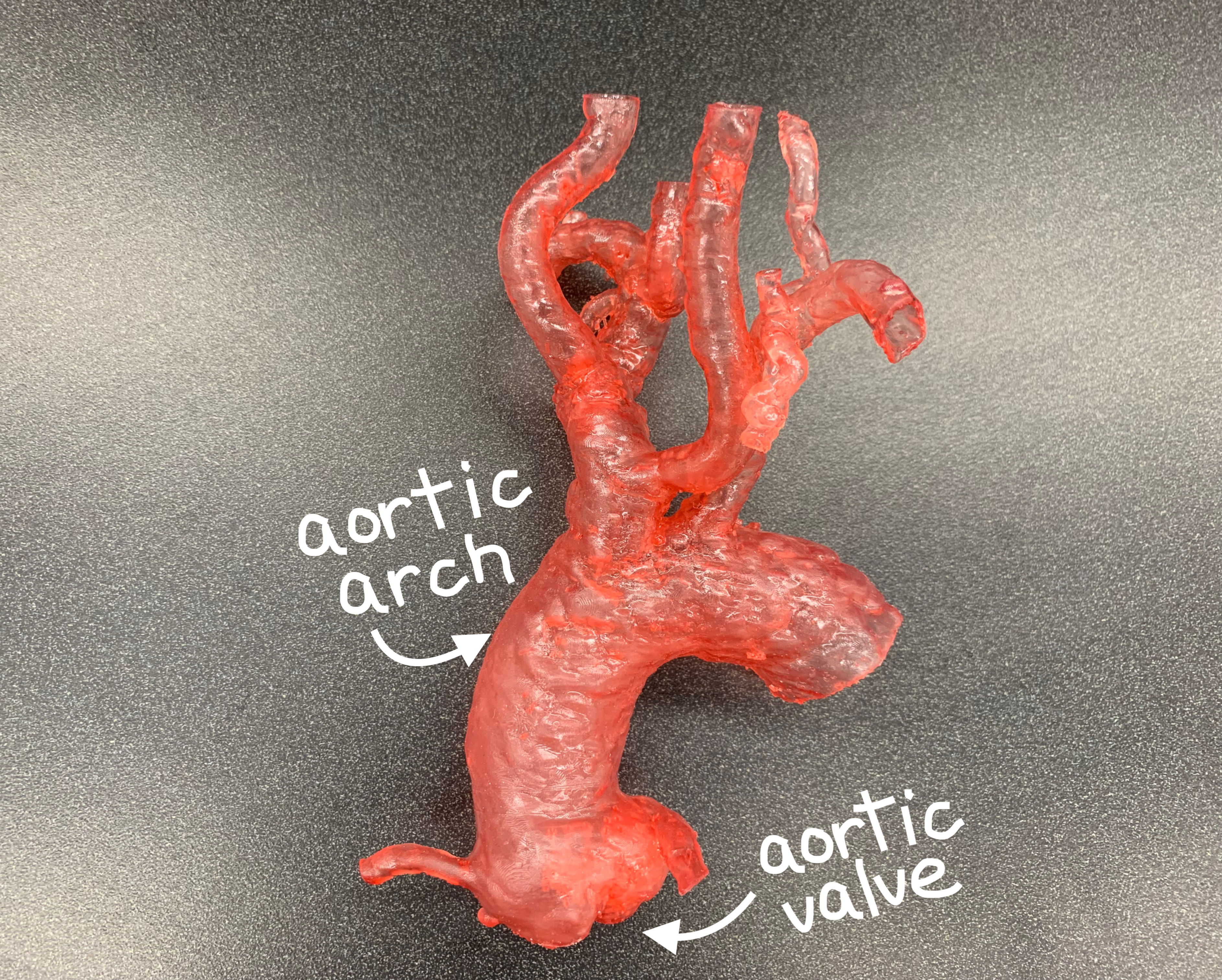 Aortic arch annotated on 3D printed model to support procedural planning for treatment of mitral valve disease. Photo via VA Puget Sound Health Care System