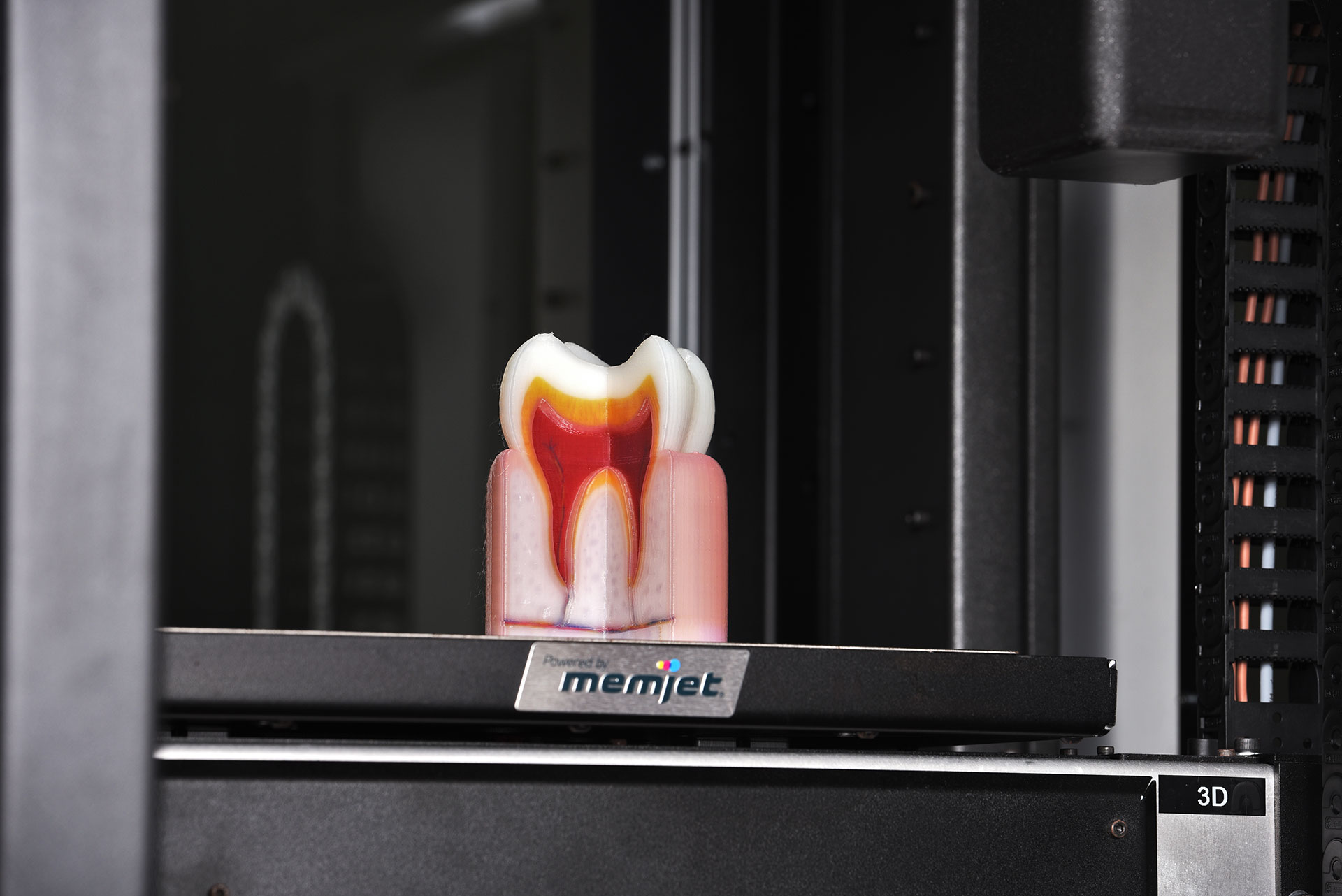 A tooth model on the OVE 3D printer printbed. Photo via OVE.