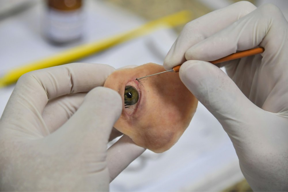 The final facial prosthesis created using a 3D printed prototype. Photo via AFP.