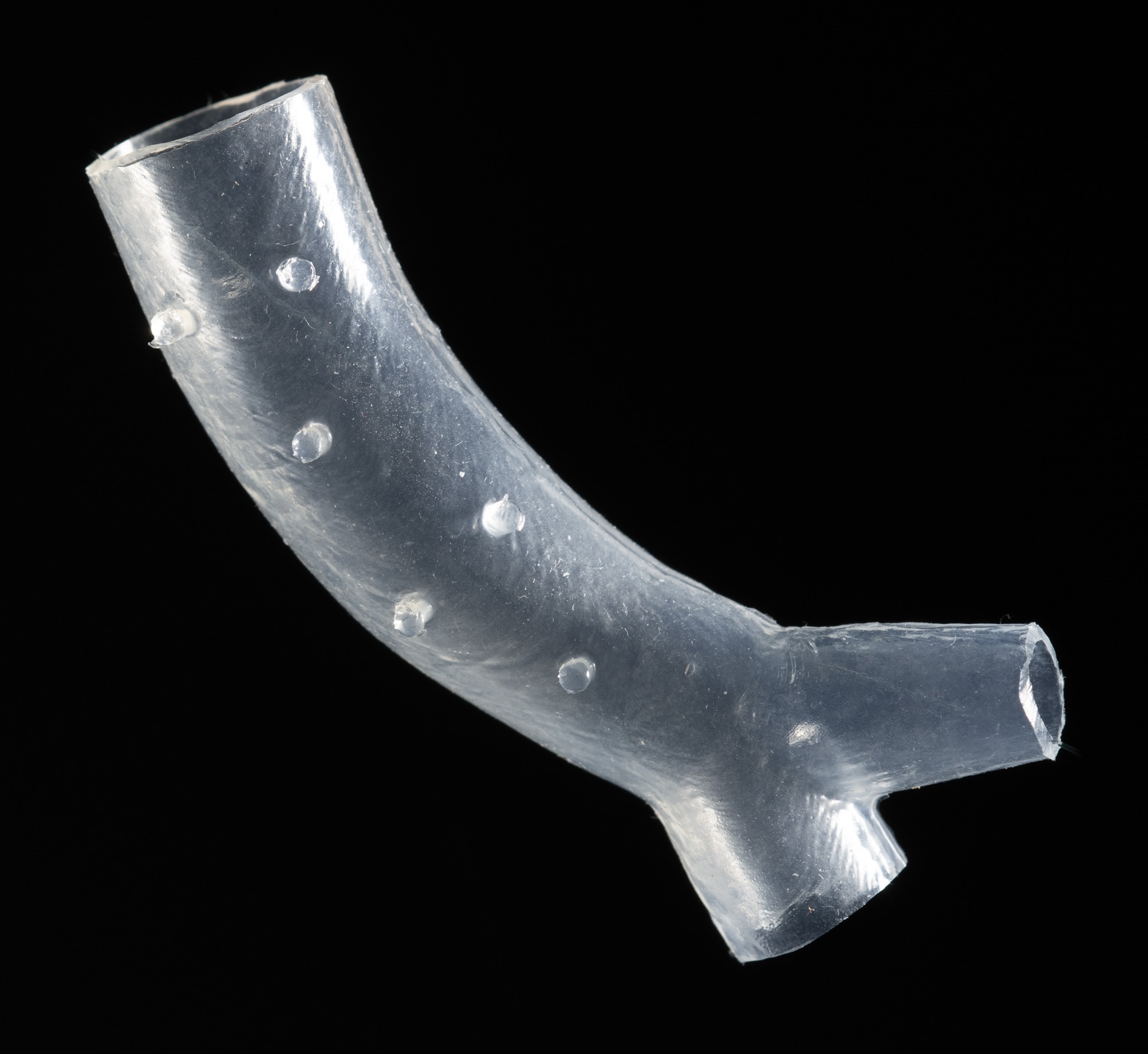 3D printed stent. Photo via Cleveland Clinic.