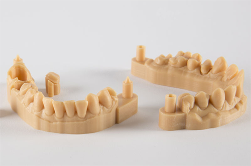 3D printed dental model. Photo via Prodways.